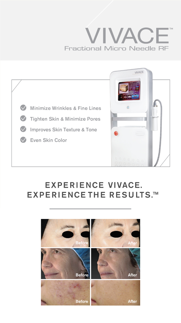 Vivace Radiofrequency Microneedling - Dermatologist In Omaha, NE ...